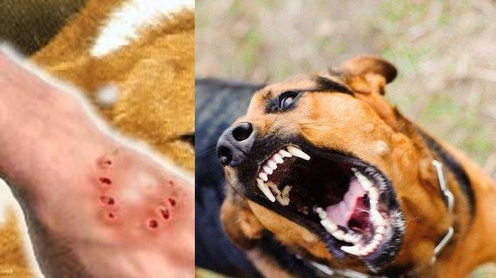 Dog Bite Lawyer