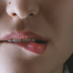 Manfaat Propolis untuk Penderita Sariawan Parah Manfaat Propolis untuk Penderita Sariawan Parah