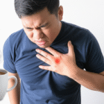 pengaruh konsumsi kafein pada penderita GERD