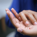 penyebab telapak tangan sering berkeringat